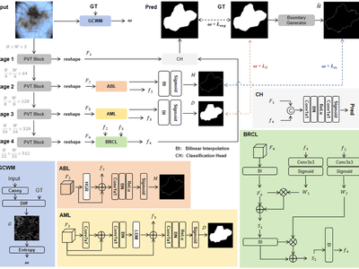 ICMBS-Former: Skin Lesion Segmentation via Boundary-Region Collaborative Optimization