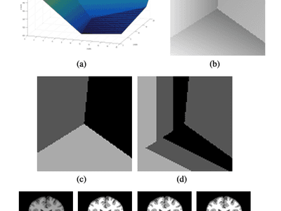 A Medical Image Segmentation Method with Anti-noise and Bias-field Correction
