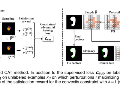 CAT: Constrained Adversarial Training for Anatomically-Plausible Semi-Supervised Segmentation